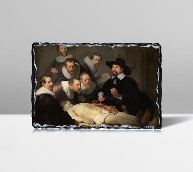 The Anatomy Lesson of Dr Nicolaes Tulp